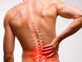 bol u donjem dijelu leđa zbog osteohondroze
